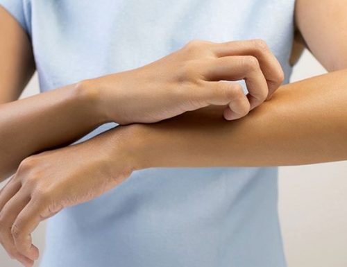 Trattamento cosmetico della dermatite atopica preventivo e lenitivo